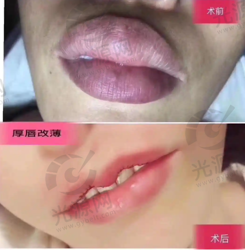 结语