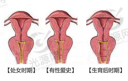 三、陕西地区颧骨突出治疗项目收费情况