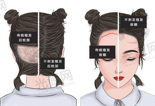 曹经栋医生的手术技术特色