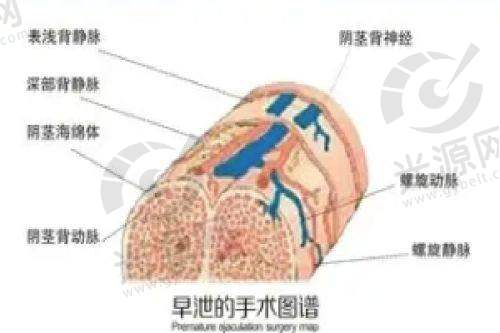 国内假体品牌:艾朗达