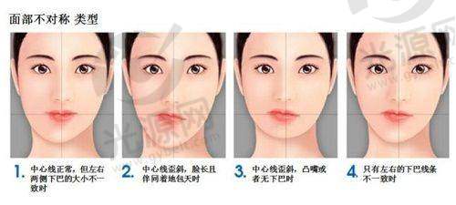 菲蜜莉成效怎么样，技术与设备保护