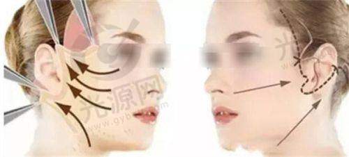 一、沈阳颜悦医疗美容中 心怎么样