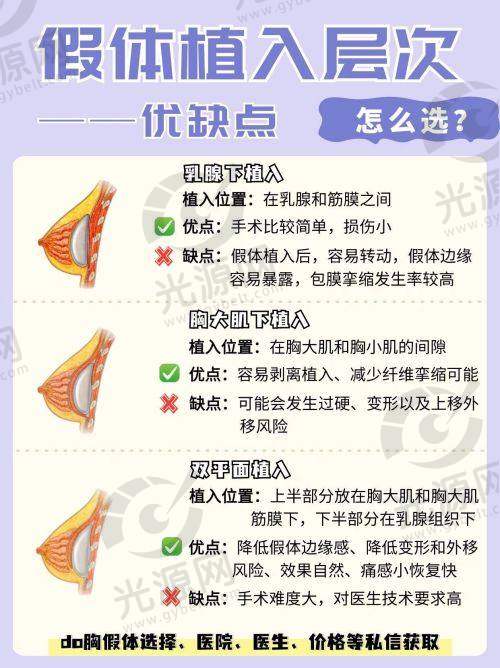 菲蜜丽激光紧缩术需要注意的术后护理