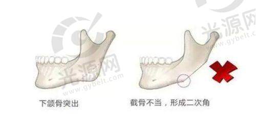 亳州蒂美整形医院怎么样? 专业团队与先进设备助力美丽蜕变