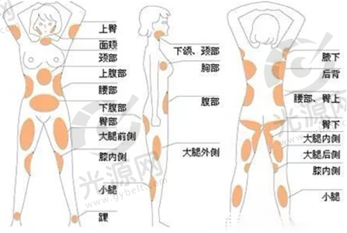 四、葫芦岛果酸换肤项目收费情况