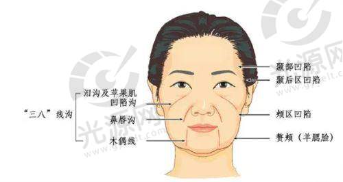 三、兰州陆 军总院光子嫩肤介绍医院口碑如何不妨来看集美们的实例评价