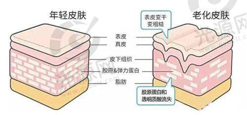 胸部整形的成功实例