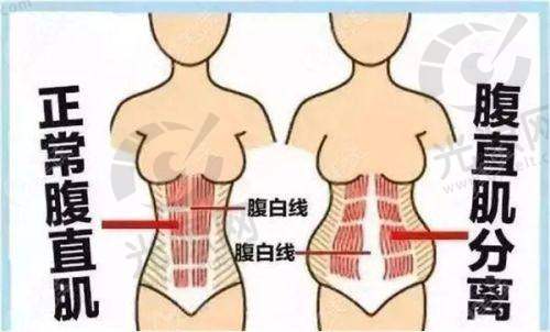二、鄂州哪家医院割眼皮每家医院的详细介绍