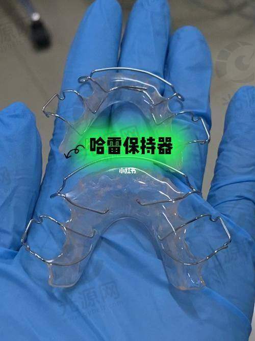 牙间隙保持器多少钱的费用构成