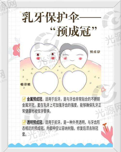 乳牙透明预成冠价格分析