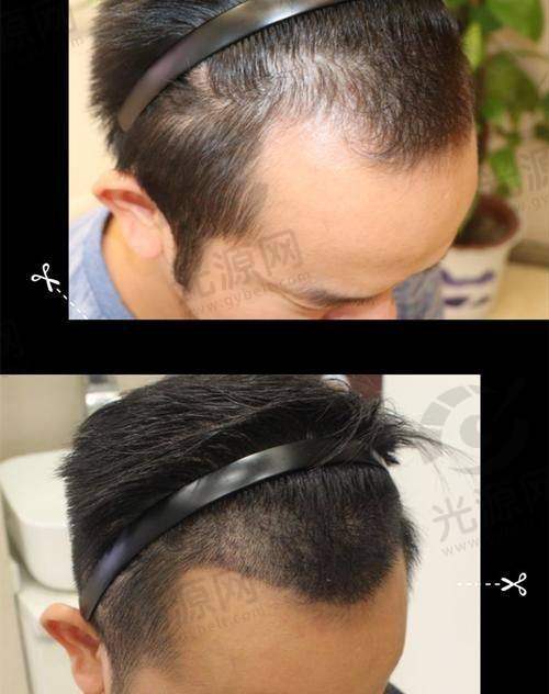 极客补发补头顶大概需要多少钱？用户反馈与注意事项