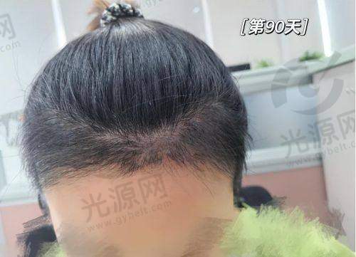 7. 上海薇琳植发医院：注重术后成效与跟踪