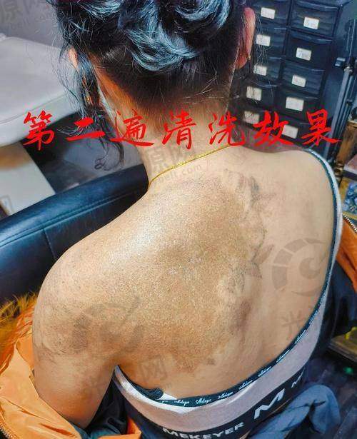 7. 楚雄灵肤医疗美容 - 特色技术引入市场