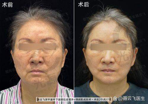总结：选择张余光医生的信心所在