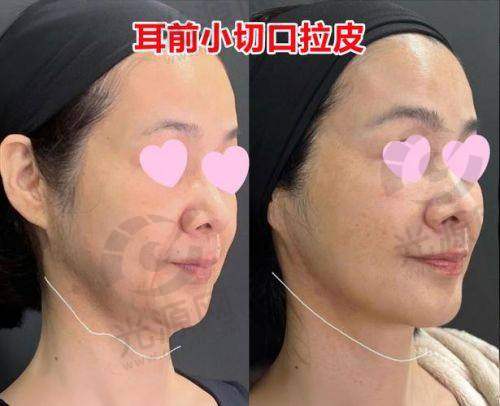 真实的用户反馈