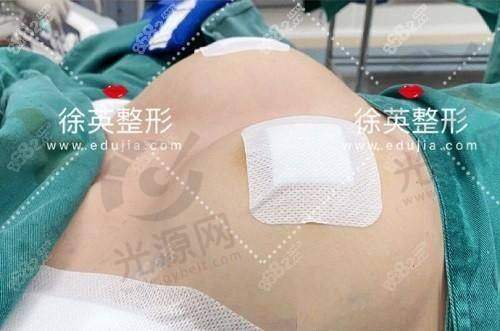 栾杰医生的手术实例分享