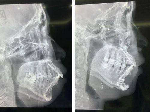 何锦泉口腔颌面外科的特色技术