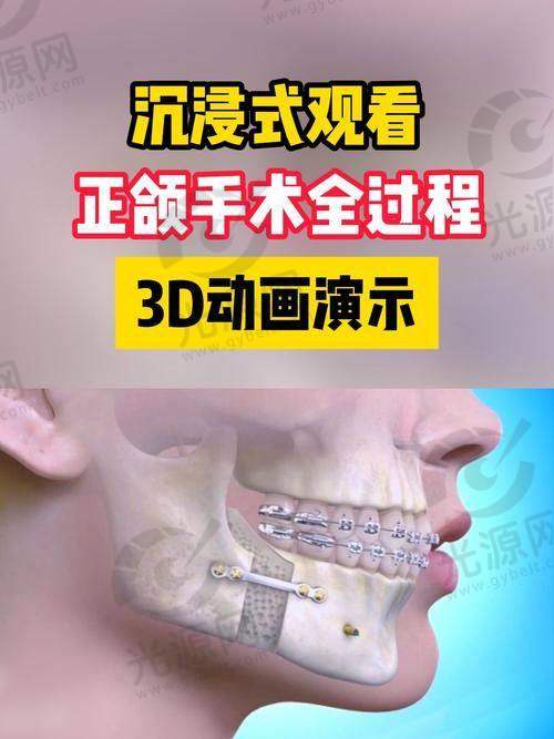 何锦泉医生的成功实例分享