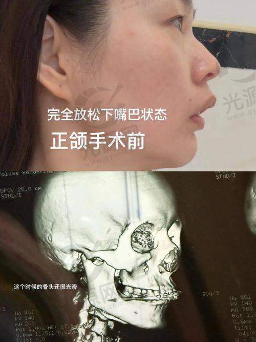 何锦泉医生在业内的口碑与成就