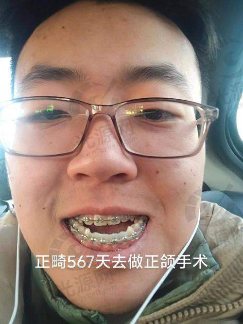 何锦泉医生挂号的便捷方式