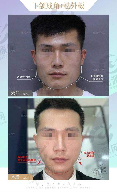 郑康在医生个人资料