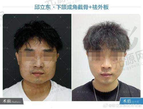 如何预约郑康在医生的手术
