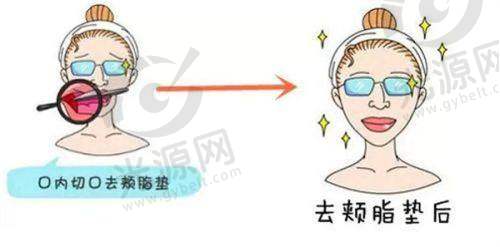 深圳美莱整形医院营业时间
