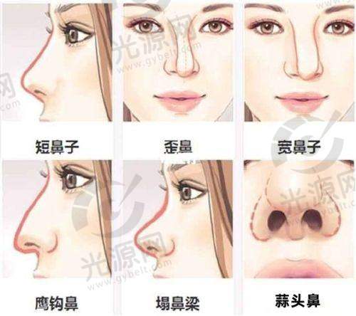 深圳南雅医疗美容门诊部特色项目