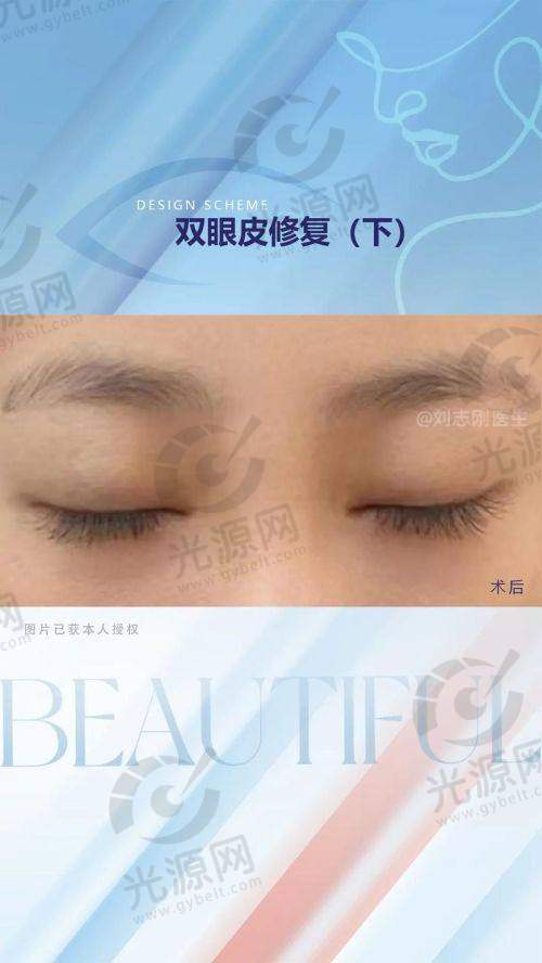 上海爱尚丽格王衡健医生擅长项目