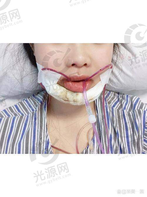 正颌手术成功几率与手术方案设计