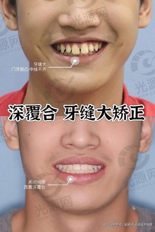 选择合适的正畸医生