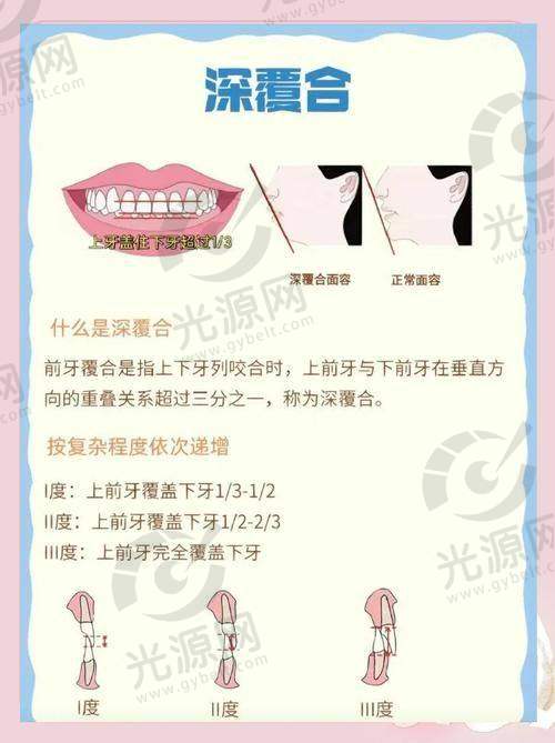 深覆合千万不要矫正，深覆合矫正必要性分析：矫正后面部变化与健康影响详解