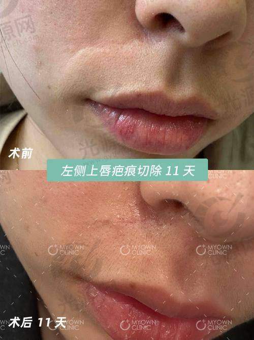 2. 南宁柏琳悦美整形医院
