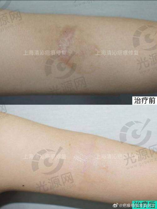 四、医院在线预约挂号快捷通道攻略