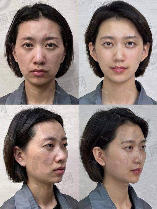 二、上海整形医院哪家更好更有名气每家医院详细介绍