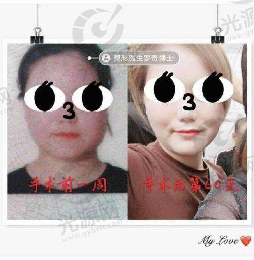 金一秀磨骨医生的背景及技术