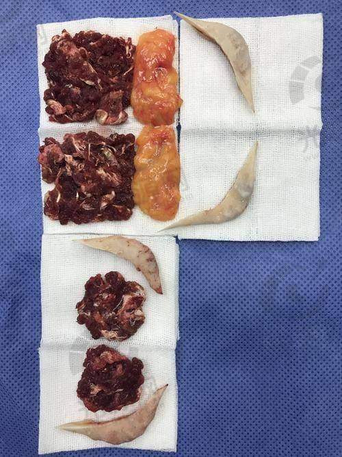 金一秀磨骨做了多少年了?