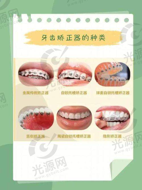 总结：半隐形矫正图片的综合价值