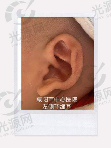 三、郑州大学第二附属医院患者的真实反馈
