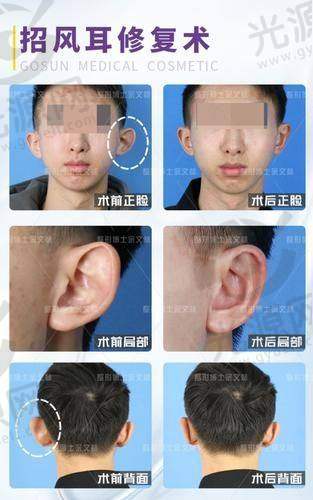六、郑州大学第二附属医院费用及明细