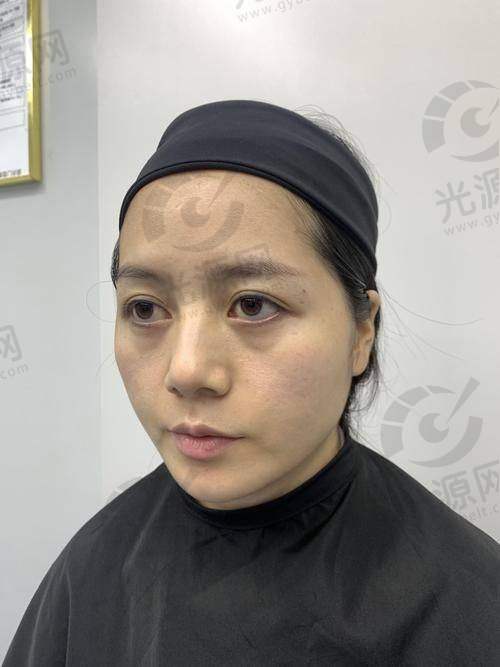五、哈尔滨眼袋医院通用在线预约挂号快捷通道