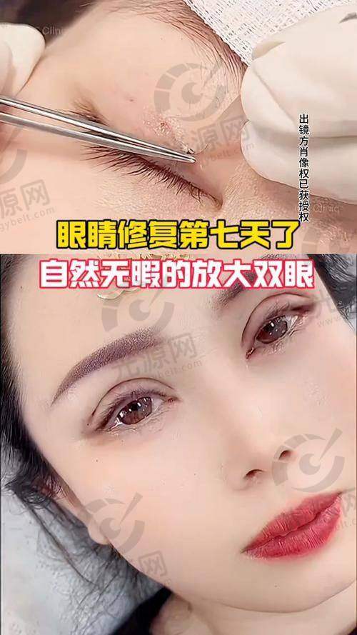 上海爱尚丽格张诗若医生怎么预约挂号