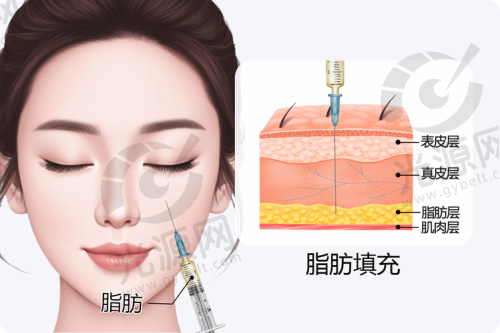 北京嘉禾整形医院刘中国医生技术特色