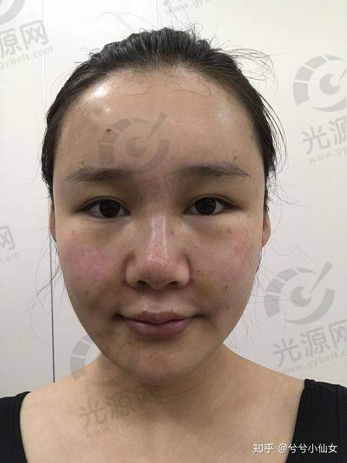 北京嘉禾整形医院刘中国医生的收费价格表