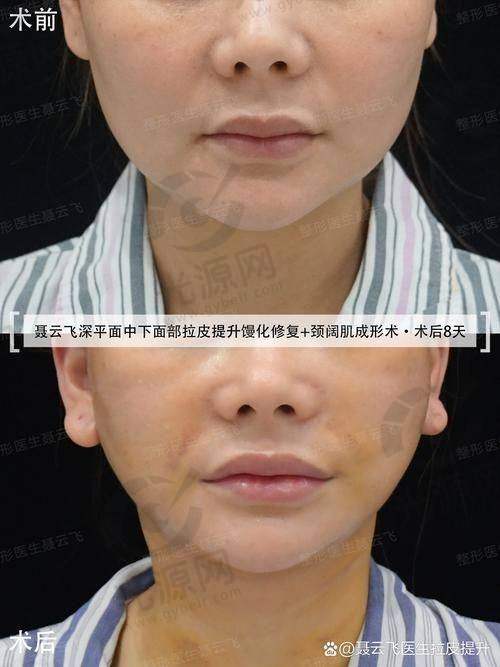 谢宏彬医生技术特色