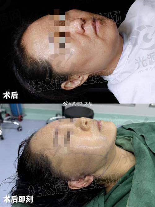 谢宏彬医生擅长项目
