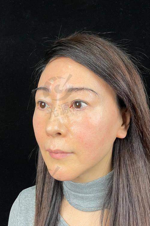 陈凤超医生技术特色