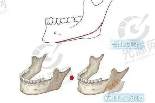 二、工人医院整形美容科擅长项目与技术优势