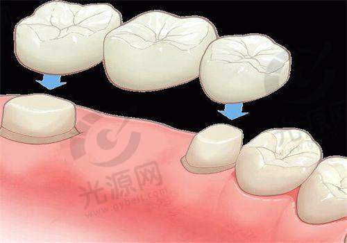 3. 美格真（Megagen）