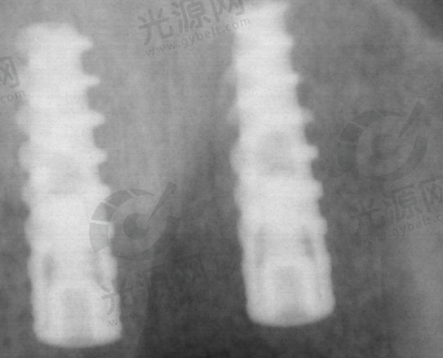 6. 登特斯（Dentis）